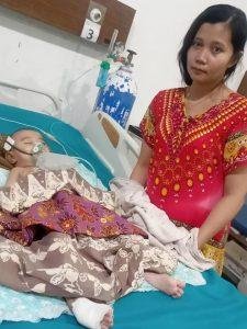 Balita Penderita Hidrosefalus di Barru Butuh Uluran Tangan