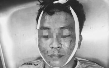 Keluarga Minta Autopsi Jenazah R, Klaim Polisi Sebut Biaya Capai Rp80 Juta